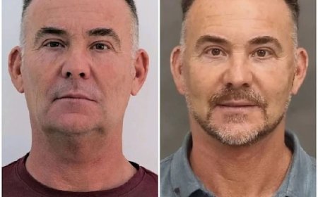 Align Beauty with Profhilo Treatments in Dubai