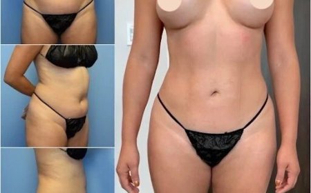How Body Contouring in Dubai Improves Your Body’s Proportions