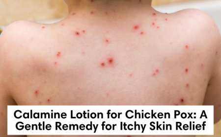 Calamine Lotion for Chicken Pox: A Gentle Remedy for Itchy Skin Relief