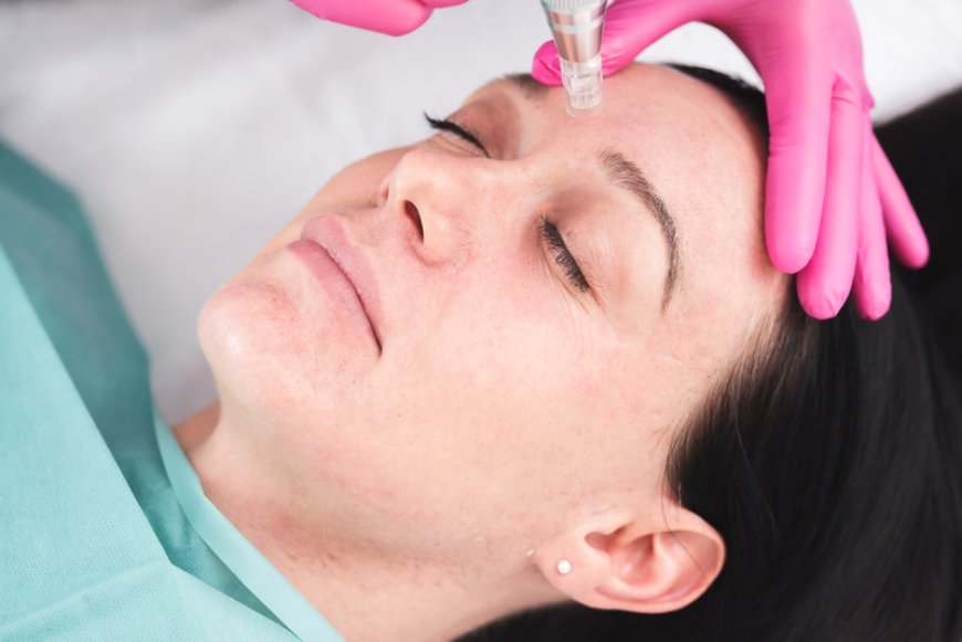 Your Radiance Discovering the Best Skin Clinic in Richmond