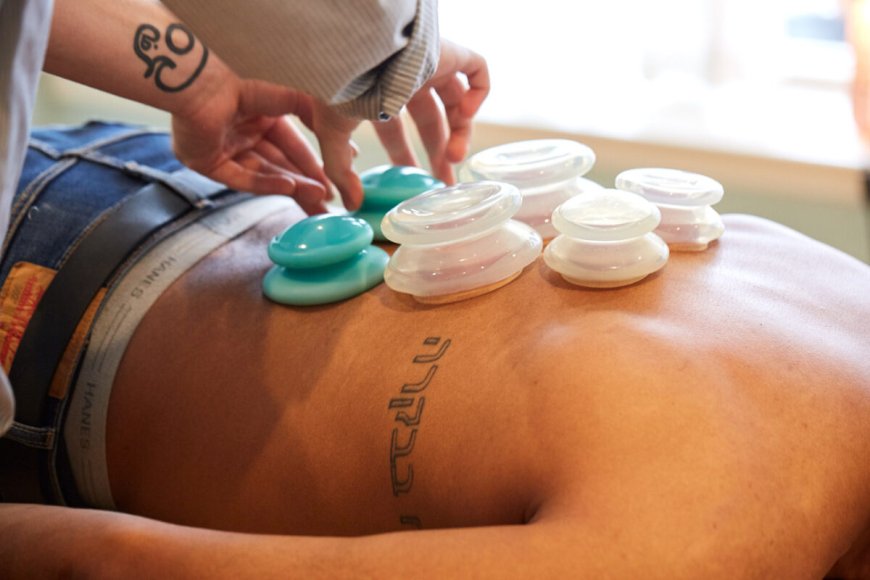 Cupping Therapy in Philadelphia: Ancient Healing Reimagined